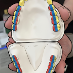 KGKデンチャーとは？