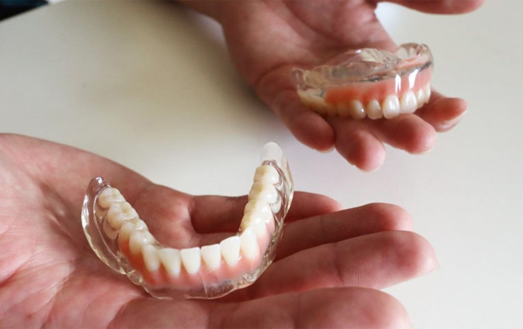 みなみテラス歯科の入れ歯の特徴