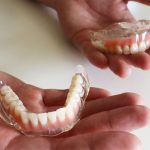 みなみテラス歯科の入れ歯の特徴