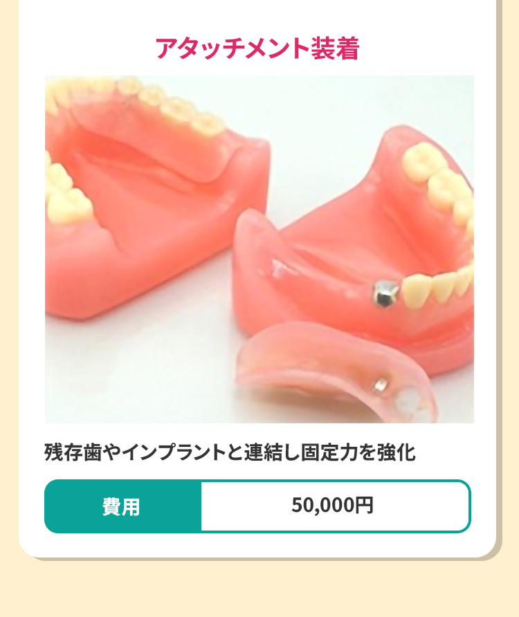 アタッチメント装着